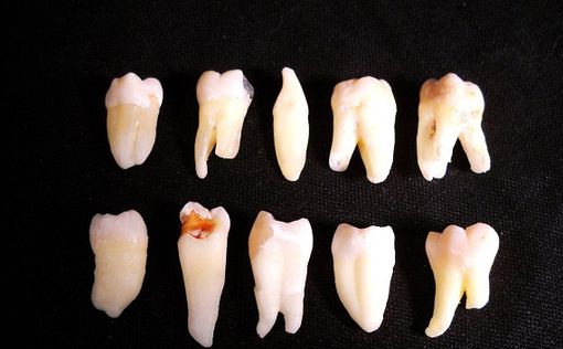 В США обнаружили тайник с тысячей человеческих зубов