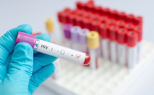 Ученые: в России появилась более опасная версия ВИЧ