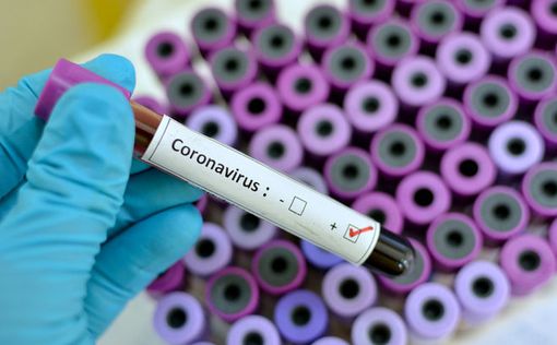 В Украине появятся быстрые тесты на выявление коронавируса