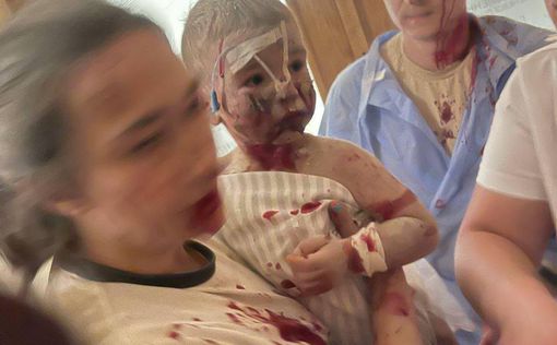 Австрия приняла на лечение детей из пострадавшей больницы Охматдет