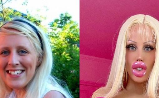 Шведка за $130 тысяч превратила себя в Барби-"проститутку". Фото | Фото: Instagram